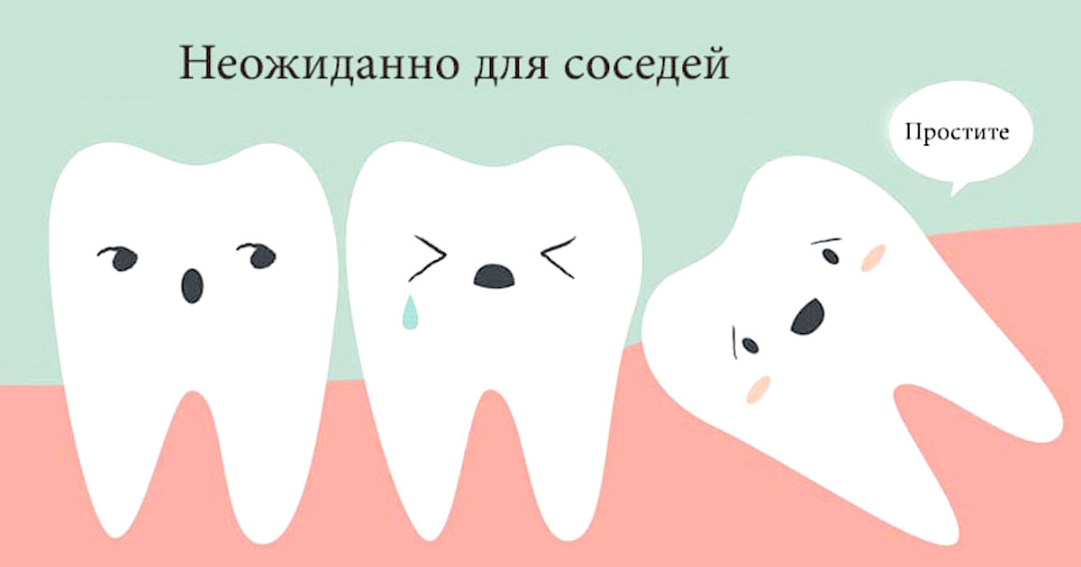 Зубы мудрости – зачем они нужны?! 