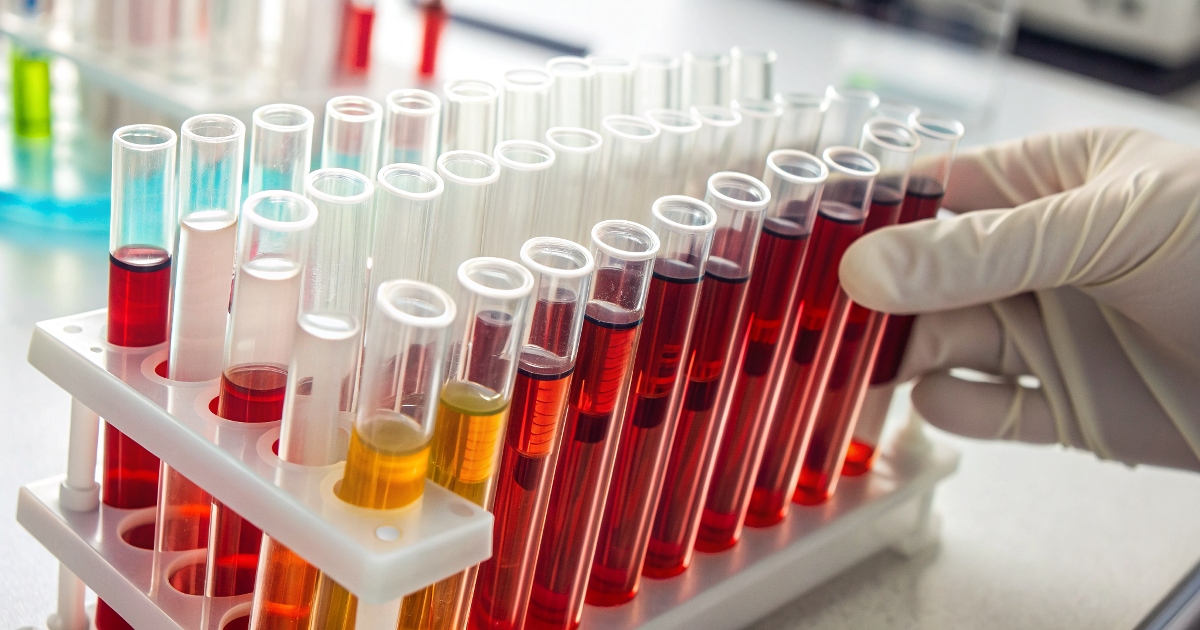 Гемоглобин у детей