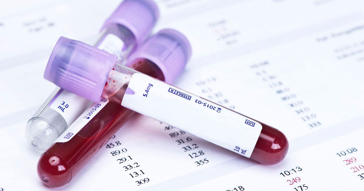 Развернутый анализ крови: когда назначают и что показывает