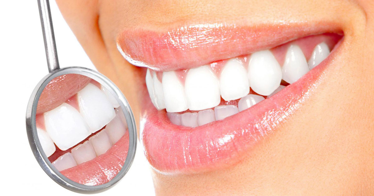 Новая услуга клиники - "Отбеливание зубов с помощью геля OpalescenceBoost"